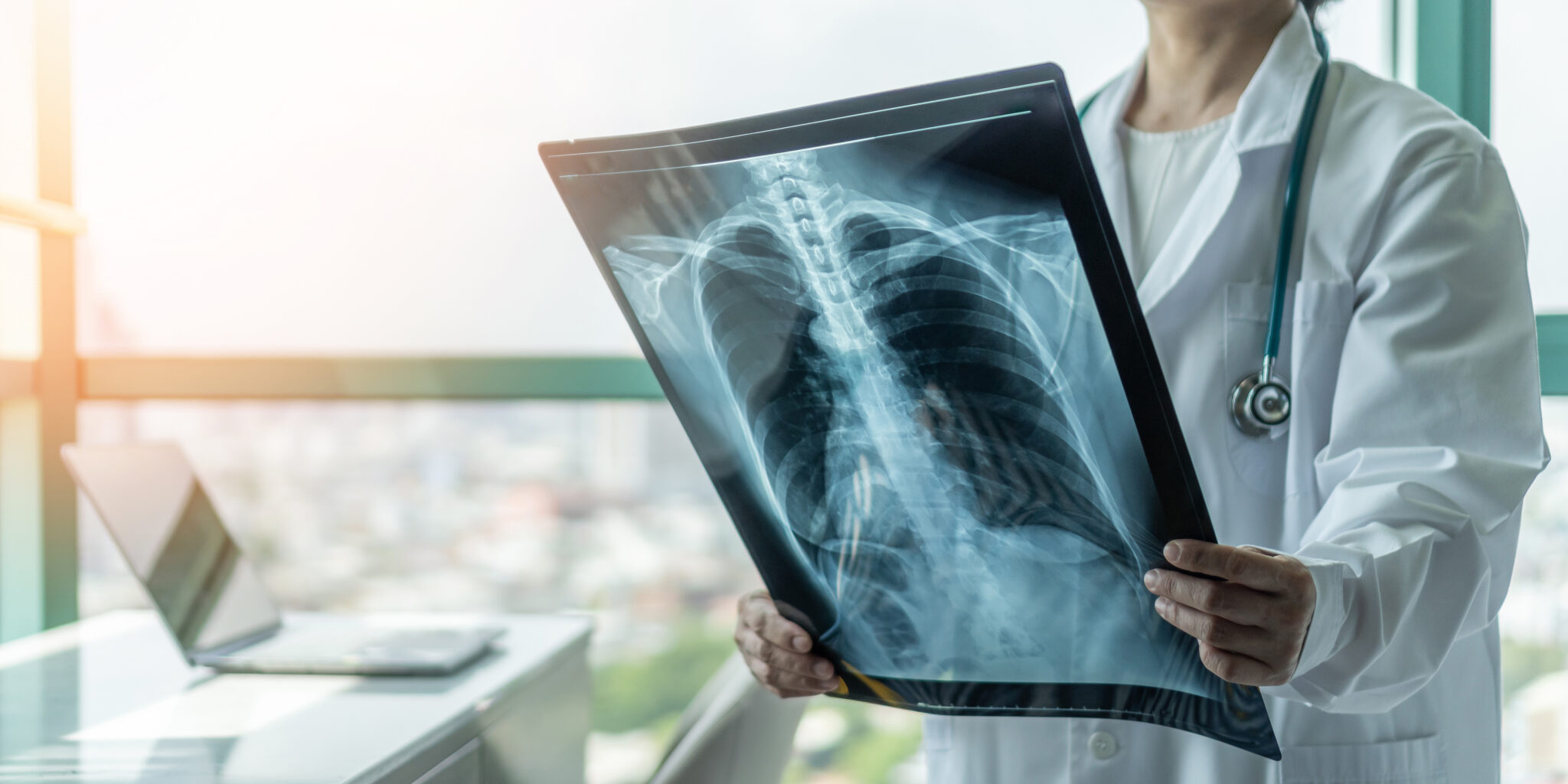 x-ray